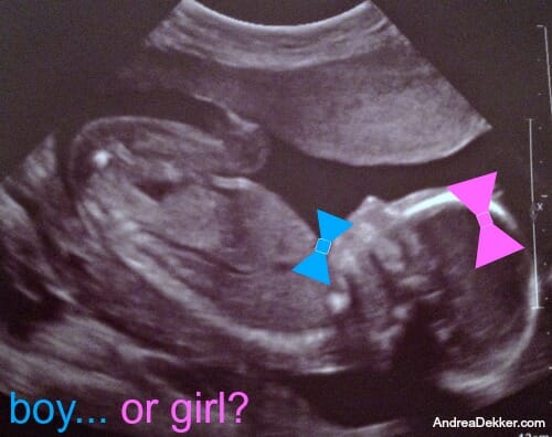 boy or girl